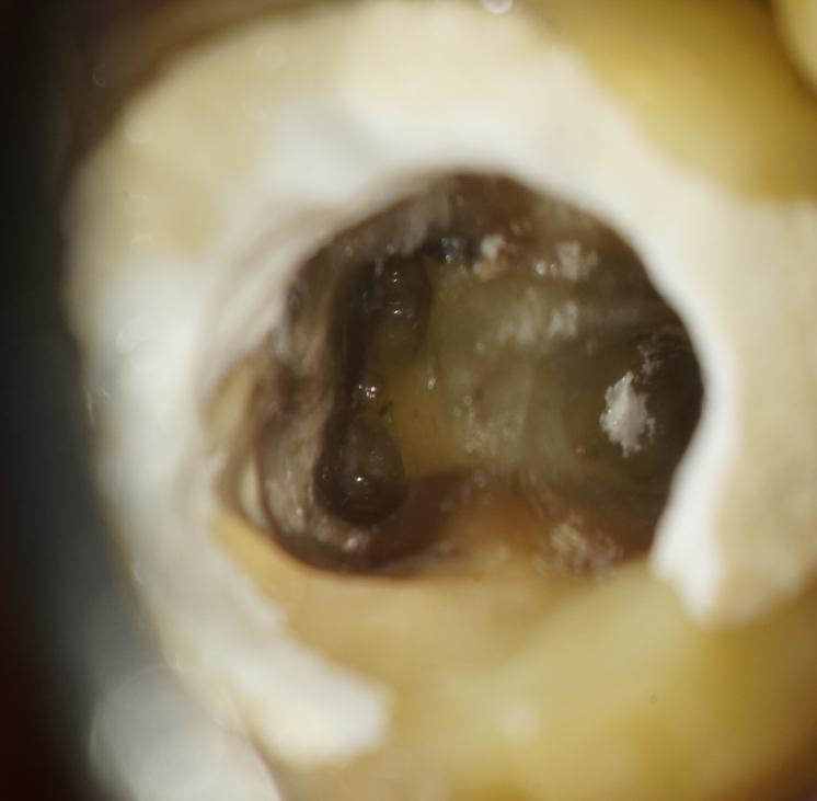 和泉市/くぼ歯科マイクロスコープ