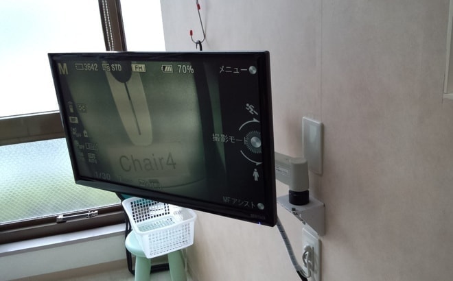 和泉市くぼ歯科/マイクロスコープモニター