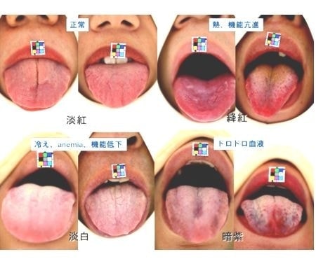 東洋医学/和泉市のくぼ歯科