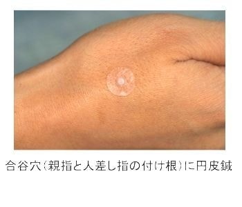 和泉市くぼ歯科/漢方